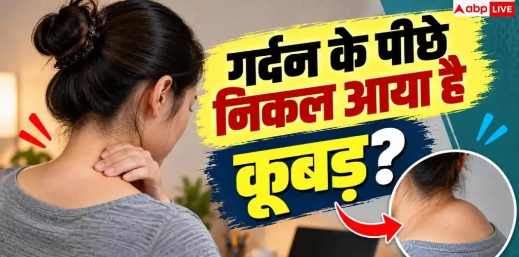 Neck Hump Exercises: क्या आपकी गर्दन में भी निकल आया कूबड़? इन 3 एक्सरसाइज से होगा ठीक – राष्ट्रवाणी